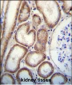 CLEC3B Antibody (Center)